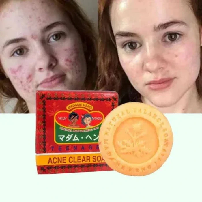 Savon Aux Herbes Thai Special Acné