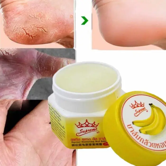 Supreme Baume Hydratant Pieds – Extrait de Banane