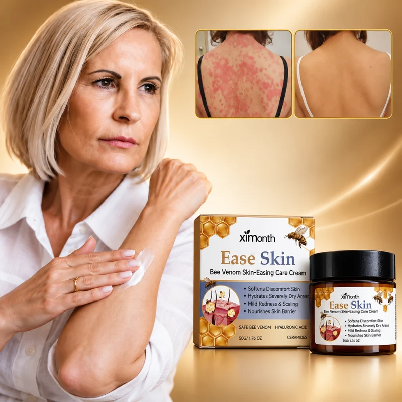 Ease Skin | Rode Huid en Irritatie in 7 Dagen Weg — Klinisch Bewezen & Natuurlijk