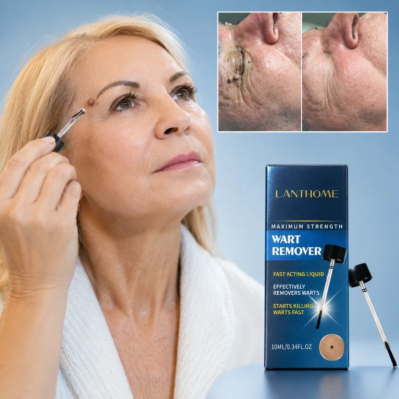 Wart Remover | Krachtige vloeistof voor hardnekkige wratten — Werkt snel voor gerichte wrattenverzorging