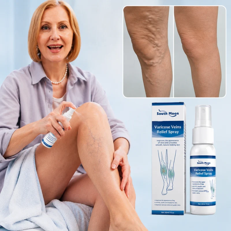 Varicose Relief Spray | Vervagen Zichtbare Aderen & Verzacht Zware Benen — Resultaten Die Je Ziet In Weken
