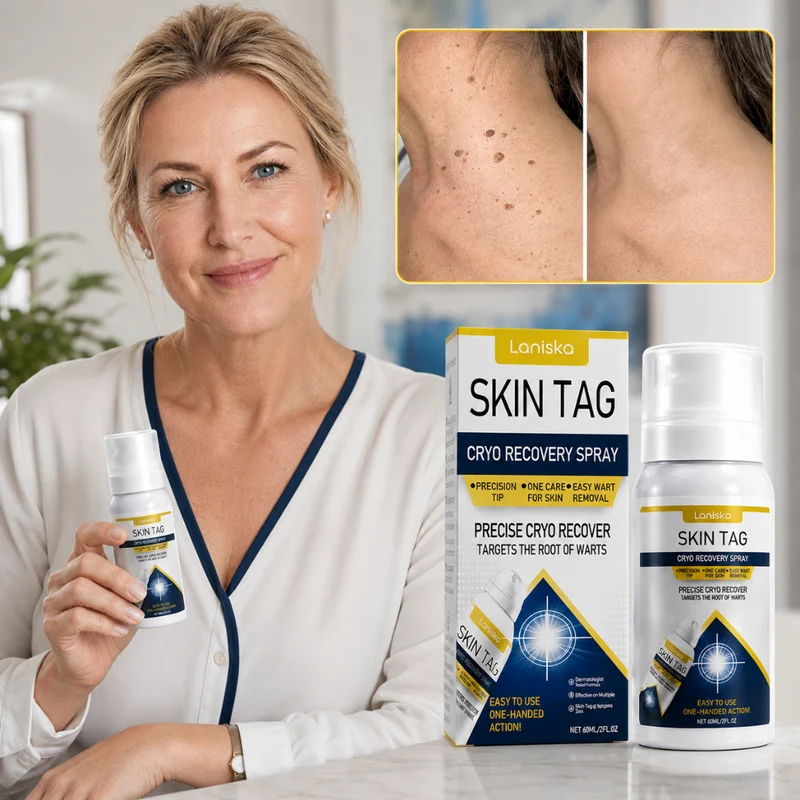 Laniska Skin Tag Cryo Treatment Spray | Verwijder Huidwratjes & Wratten Permanent In 14 Dagen