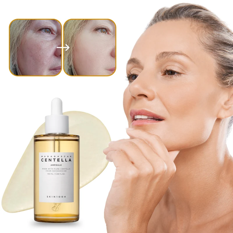 Centella™ | Verzacht Puistjes. Hydrateer Zonder Zorgen