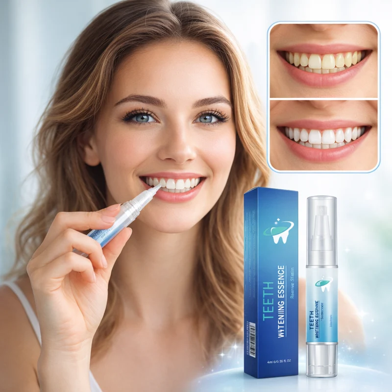 Teeth Whitening Essence Pen | Ondersteunt zichtbaar wittere tanden bij dagelijks gebruik